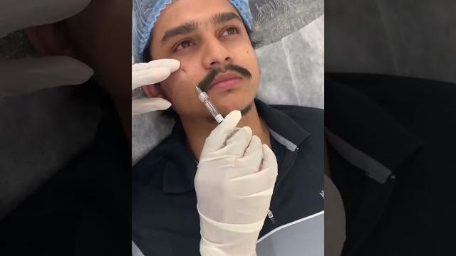 #dorasaiteja dark circle treatment at hk permanentmakeup clinic ..9052339052 hyderabad & vijayawada #dorasaiteja dark circle treatment at hk permanentmakeup clinic ..9052339052 hyderabad & vijayawada