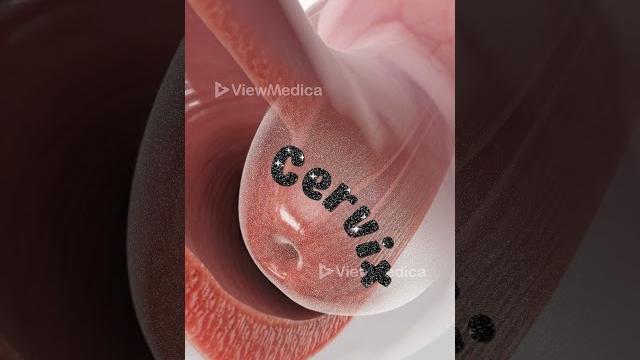 Pap smear (3d animation) Pap smear (3d animation)