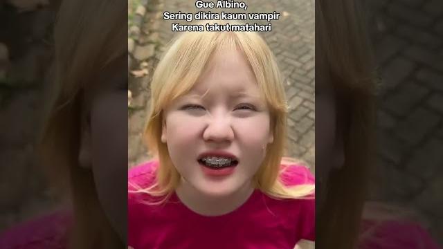 Gue albino.... Gue albino....