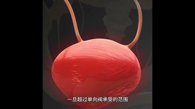 習慣憋尿對腎臟的傷害有多大 #健康養生 #生活科普#腎結石 #尿路感染 # 習慣憋尿對腎臟的傷害有多大 #健康養生 #生活科普#腎結石 #尿路感染 #