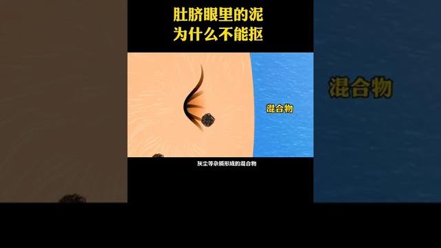 肚脐眼里的泥为什么不能抠。 #科普 #寻找1000位科普达人 #快手科普 肚脐眼里的泥为什么不能抠。 #科普 #寻找1000位科普达人 #快手科普