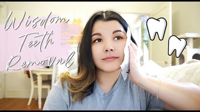 I got my wisdom teeth removed I got my wisdom teeth removed