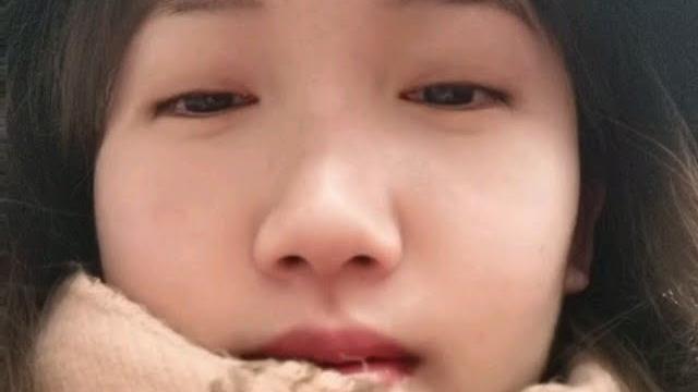 脑门长痘了 带个帽子遮一遮 脑门长痘了 带个帽子遮一遮