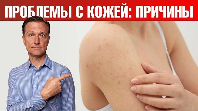 Ваша кожа расскажет вам о проблемах с пищеварением Ваша кожа расскажет вам о проблемах с пищеварением