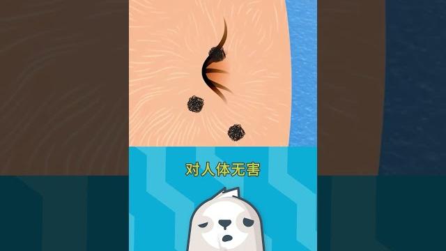 抠肚脐眼 抠肚脐眼