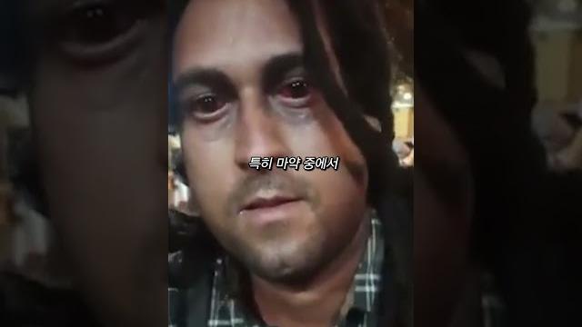 펜타닐 중독자들의 이상 증세 펜타닐 중독자들의 이상 증세