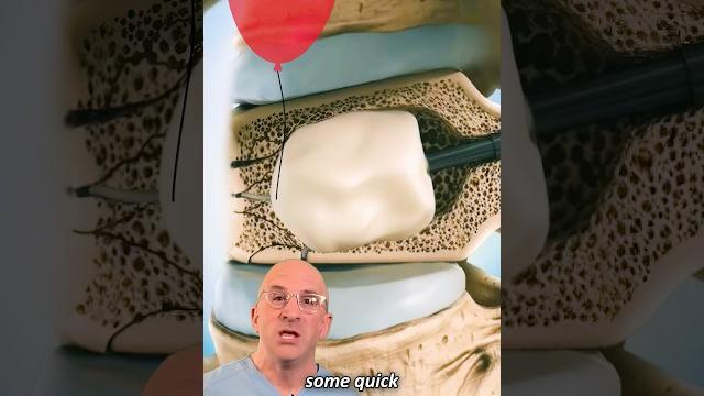 Innovative spine fracture treatment: balloon + cement #shorts Innovative spine fracture treatment: balloon + cement #shorts