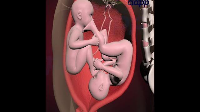 Amazing twins fighting inside the womb for supremacy (3d animation) Amazing twins fighting inside the womb for supremacy (3d animation)