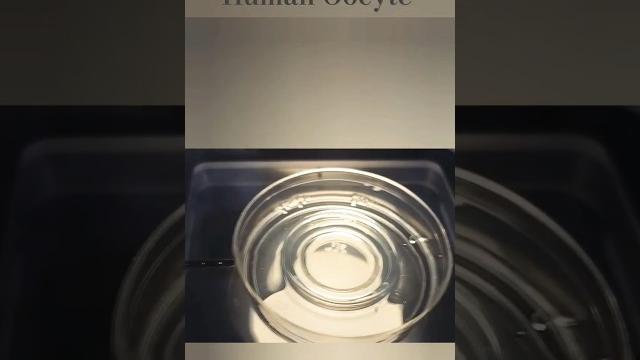 Human oocyte #oocyte #oogenesis Human oocyte #oocyte #oogenesis