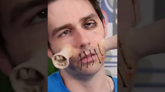 Boy gets real life siren head surgery! #shorts Boy gets real life siren head surgery! #shorts