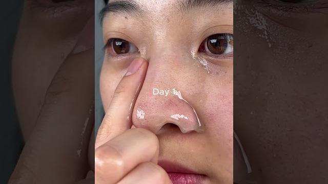 Collagen serum #orien #serum #collagen #mugwort Collagen serum #orien #serum #collagen #mugwort