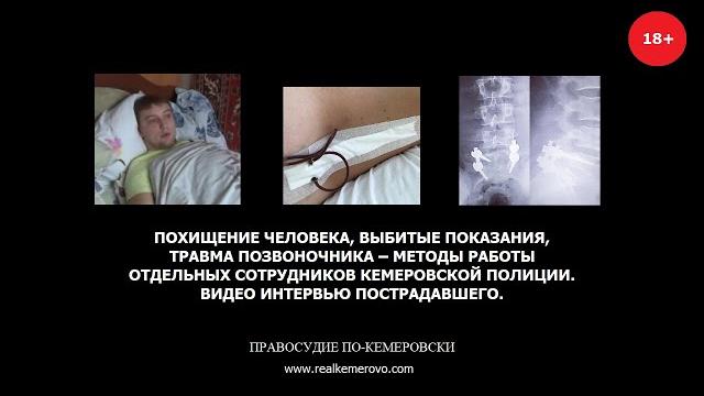 Похищение человека, выбитые показания, травма позвоночника - видео интервью пострадавшего Похищение человека, выбитые показания, травма позвоночника - видео интервью пострадавшего