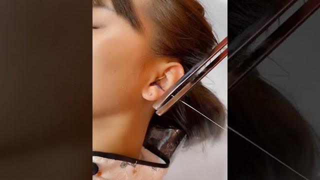 Ear cleaning Ear cleaning