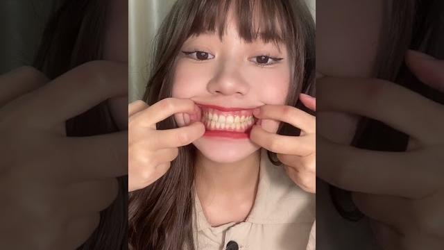 关注女大学生口腔健康口腔检查牙齿喉咙扁桃体欣赏了解更多qq507871282 关注女大学生口腔健康口腔检查牙齿喉咙扁桃体欣赏了解更多qq507871282