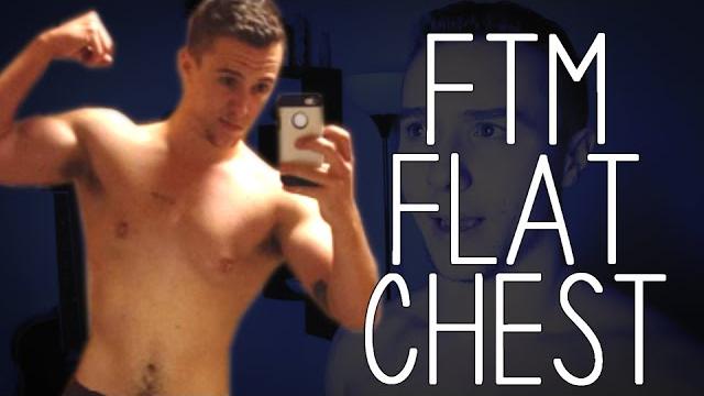 Flat chest without surgery? -ftm Flat chest without surgery? -ftm