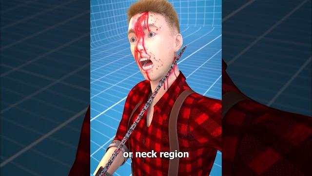 How chainsaw kickback works How chainsaw kickback works