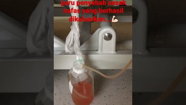 Proses pengeluaran cairan paru penyebab sesak nafas... #pejuangkanker #kankerpayudara #kankerparu Proses pengeluaran cairan paru penyebab sesak nafas... #pejuangkanker #kankerpayudara #kankerparu