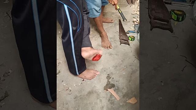 Trik kalau keinjak paku , tonton sampai habis Trik kalau keinjak paku , tonton sampai habis