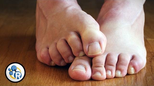 Why do feet smell? Why do feet smell?