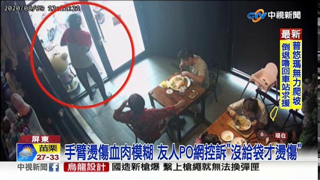 痛! 左手臂遭燙傷 外送員控店未提供袋子│中視新聞 20200810 痛! 左手臂遭燙傷 外送員控店未提供袋子│中視新聞 20200810
