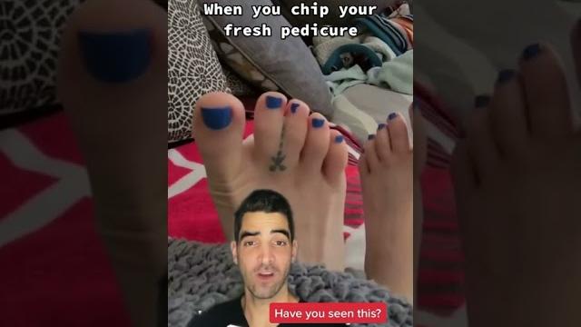 Webbed toes Webbed toes