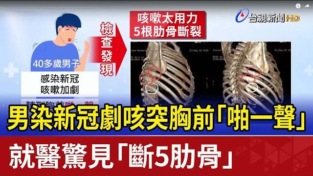 男染新冠劇咳突胸前「啪一聲」 就醫驚見「斷5肋骨」 男染新冠劇咳突胸前「啪一聲」 就醫驚見「斷5肋骨」