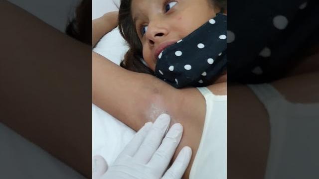 1° depilação de maria júlia na cera quente suvaco/axilas 1° depilação de maria júlia na cera quente suvaco/axilas