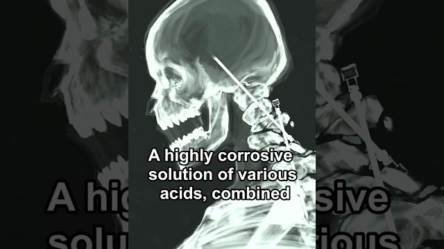 Scp-096 is dead!!! Scp-096 is dead!!!