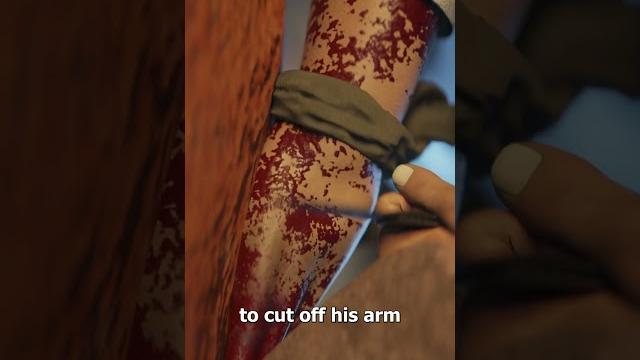 The man who cut off his own arm The man who cut off his own arm