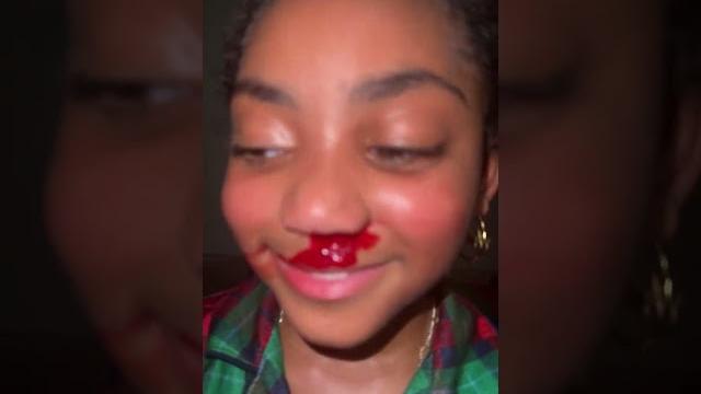 Lani love got a nose bleed #shorts #lanilove #nosebleed Lani love got a nose bleed #shorts #lanilove #nosebleed