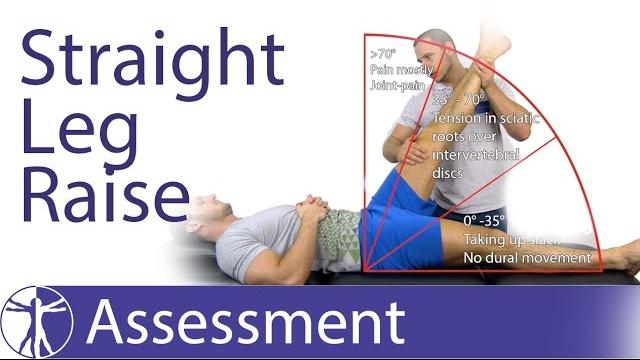 Straight leg raise or lasègue's test for lumbar radiculopathy Straight leg raise or lasègue's test for lumbar radiculopathy
