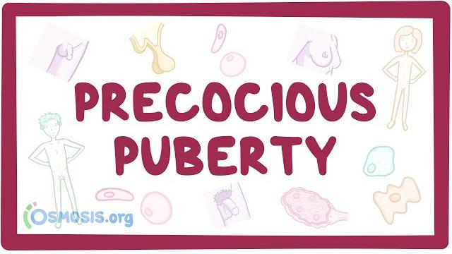 Precocious puberty (year of the zebra) Precocious puberty (year of the zebra)