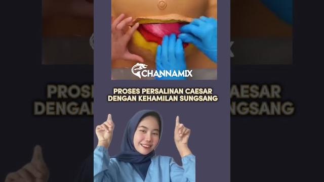 Proses melahirkan caesar - medikacare Proses melahirkan caesar - medikacare