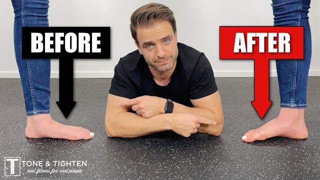 How to fix flat feet with exercises at home How to fix flat feet with exercises at home