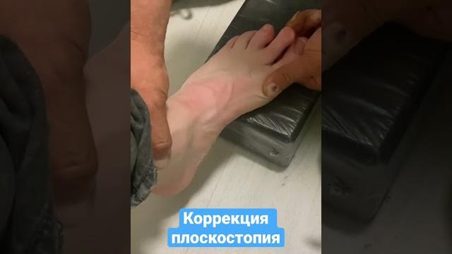 Создаем условия для правильной геометрии ног и тела #школаног #плоскостопие #стельки #шпора #вальгус Создаем условия для правильной геометрии ног и тела #школаног #плоскостопие #стельки #шпора #вальгус