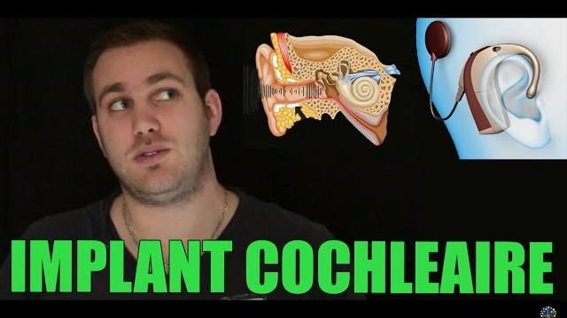 5mintech #3 - l'implant cochléaire 5mintech #3 - l'implant cochléaire