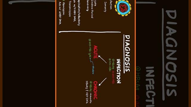 Part 2/3 hepatitis b diagnosis #usmle Part 2/3 hepatitis b diagnosis #usmle