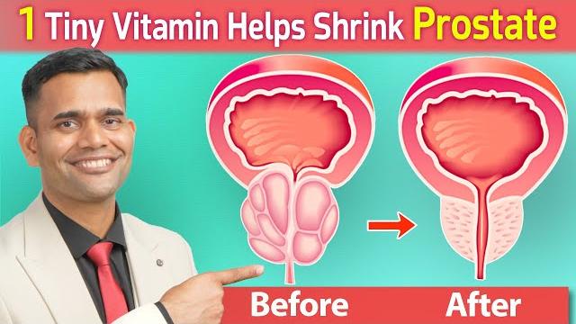 1 tiny vitamin helps shrink prostate | vitamin to shrink enlarged prostate - dr. vivek joshi 1 tiny vitamin helps shrink prostate | vitamin to shrink enlarged prostate - dr. vivek joshi