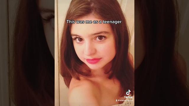 What happened to my face?#babyface #funny #teenager What happened to my face?#babyface #funny #teenager