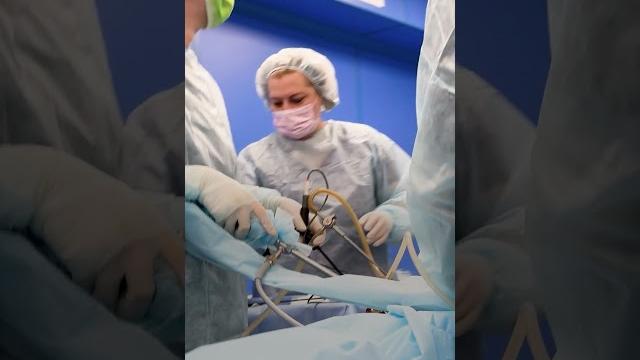 Удаление кисты яичника. лапароскопия Удаление кисты яичника. лапароскопия
