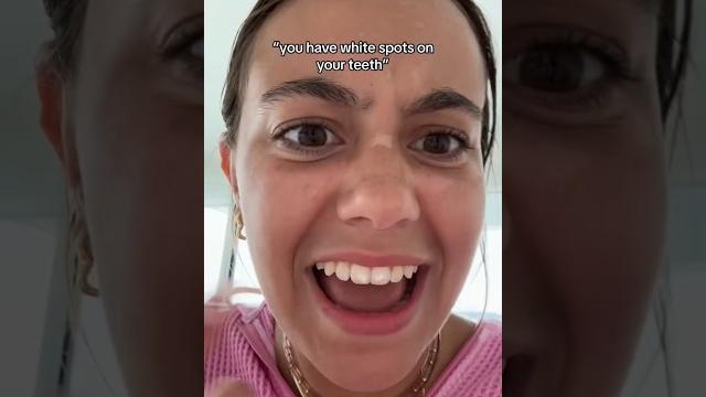 What are those weird spots on her teeth?! What are those weird spots on her teeth?!