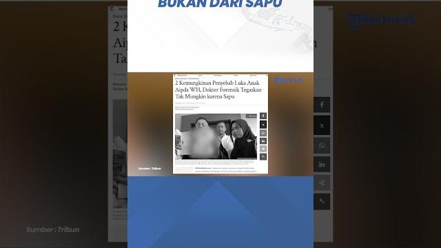 Makin jelas, dokter forensik saksi ahli sidang guru supriyani sebut luka korban bukan dari sapu Makin jelas, dokter forensik saksi ahli sidang guru supriyani sebut luka korban bukan dari sapu