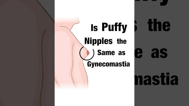 Are puffy nipples the same as gynecomastia? dr. aniketh venkataram, the venkat center, bengaluru Are puffy nipples the same as gynecomastia? dr. aniketh venkataram, the venkat center, bengaluru