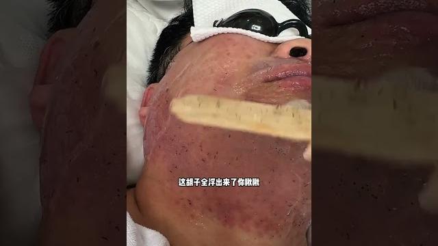 葫蘆島的大哥 覺得鬍子埋汰不想要了#瀋陽 #解壓 #男士修面 #絡腮鬍 #脫鬍子 葫蘆島的大哥 覺得鬍子埋汰不想要了#瀋陽 #解壓 #男士修面 #絡腮鬍 #脫鬍子