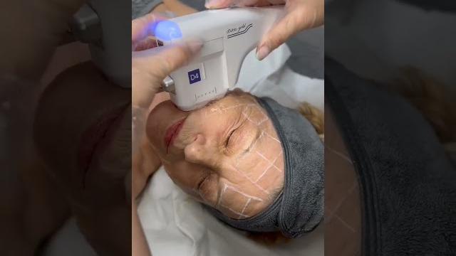 Radio frequency and hifu combination treatment - clinicbe #rf #hifu #clinicbe #skin #antiaging Radio frequency and hifu combination treatment - clinicbe #rf #hifu #clinicbe #skin #antiaging