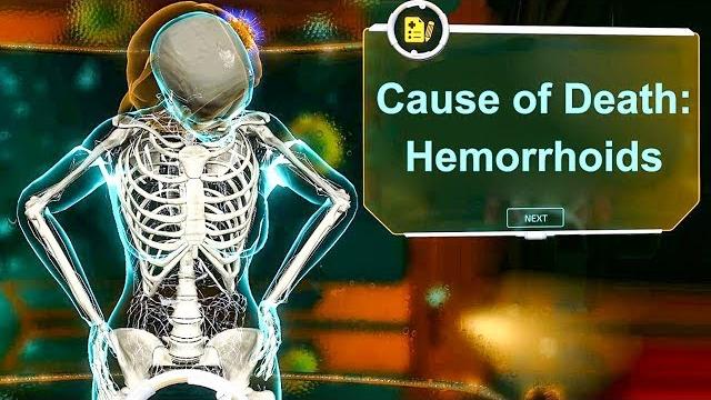 Using hemorrhoids to torture people to death Using hemorrhoids to torture people to death