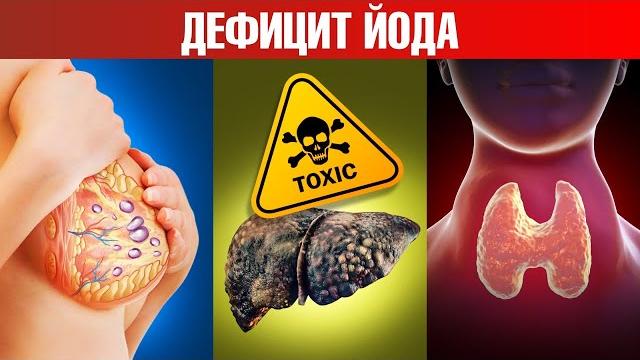 5 важных сигналов о том, что у вас дефицит йода 5 важных сигналов о том, что у вас дефицит йода