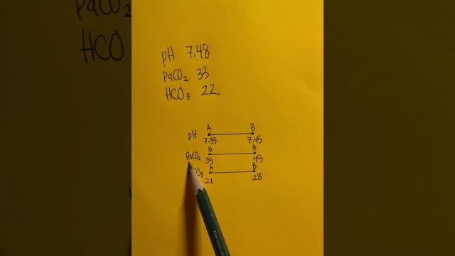 Abgs #abg #acidbase #nurse #nursing #nursingskills #nursingschool #nursingstudent #medical #shorts Abgs #abg #acidbase #nurse #nursing #nursingskills #nursingschool #nursingstudent #medical #shorts