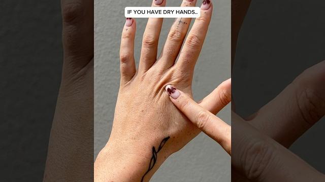 Your dry hands could be from excess sun exposure 🫢️ Your dry hands could be from excess sun exposure 🫢️
