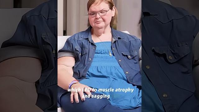 Have you noticed the swollen lumps on tammy slaton's legs? #celebrity #fyp #entertainment Have you noticed the swollen lumps on tammy slaton's legs? #celebrity #fyp #entertainment